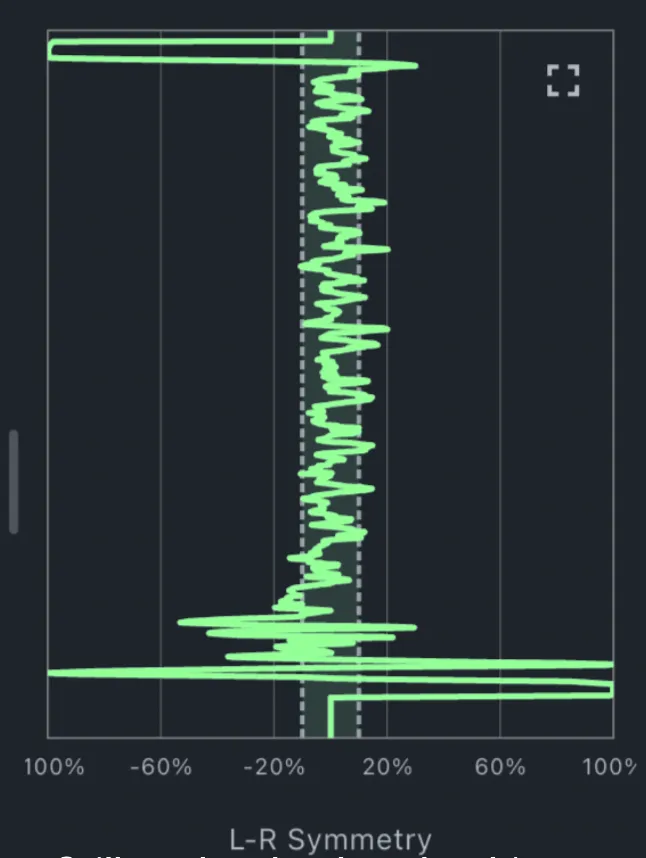 ForceMate left-right symmetry trace from the ACL patient’s squat, mostly within the ±10% band